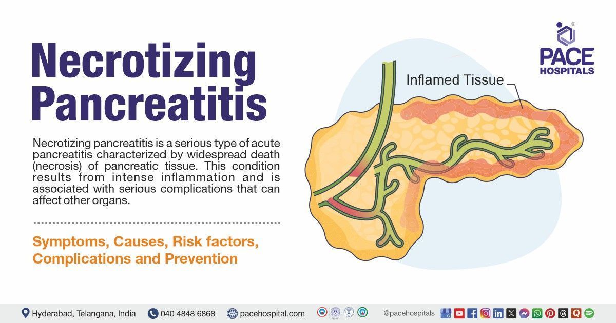 Acute Necrotizing Pancreatitis symptoms  | necrotizing pancreatitis treatment in India