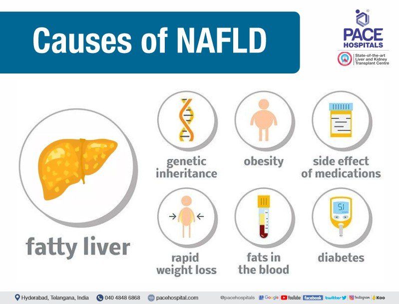 nafld causes - non alcoholic fatty liver disease