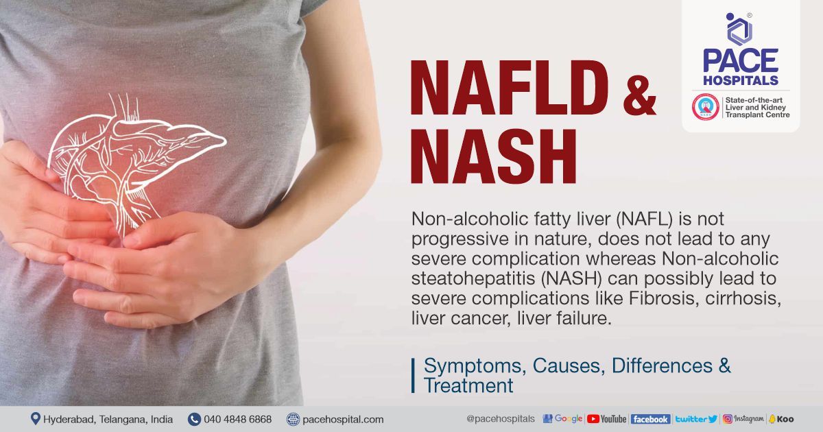 NAFLD and NASH - Symptoms, Causes, Differences and Treatment | NAFLD vs NASH