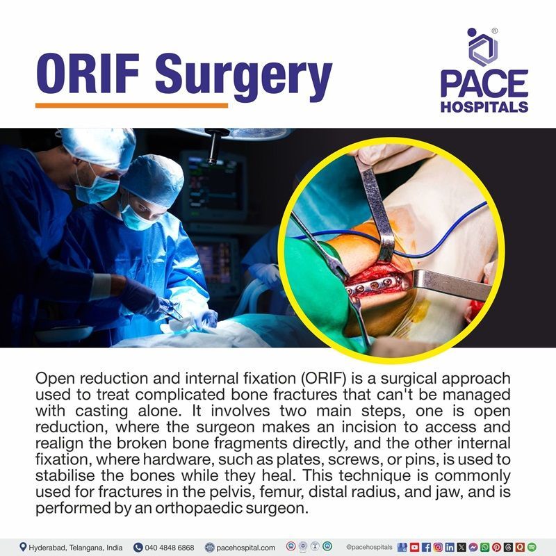 What is ORIF Surgery? | ORIF Procedure