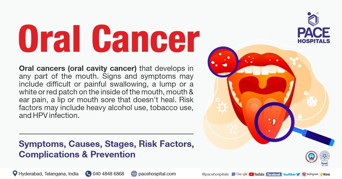 Oral Cancer – Symptoms, Causes, Stages, Risk Factors, Complications & Prevention