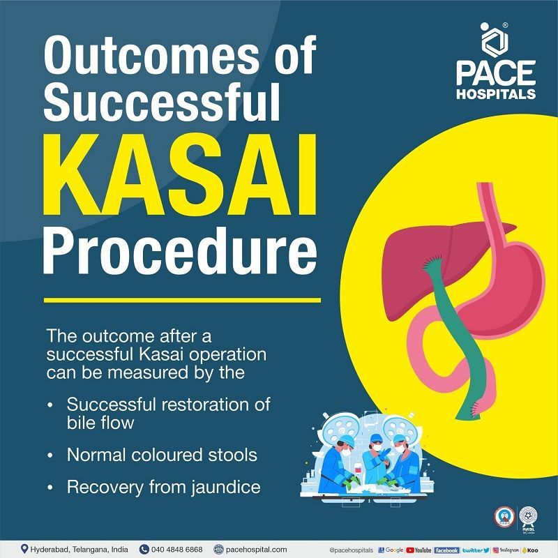 Outcome after successful the Kasai Procedure for biliary atresia treatment | Best Hospital in India for Kasai Procedure