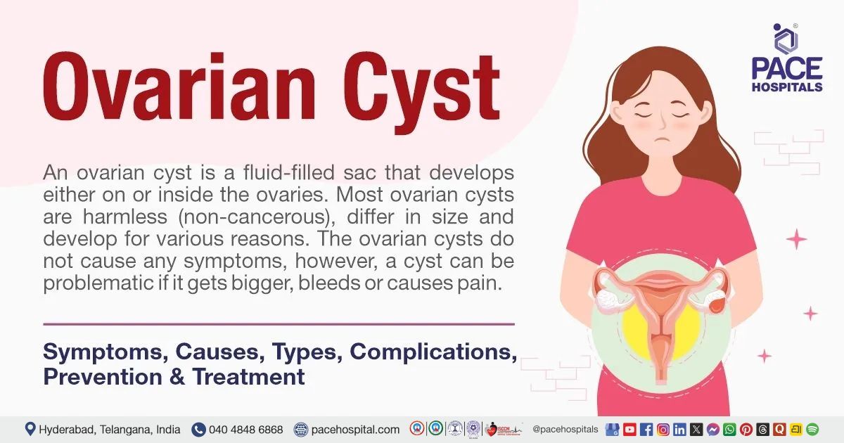 Ovarian cyst - Symptoms, Causes, Types, Complications, Prevention & Treatment