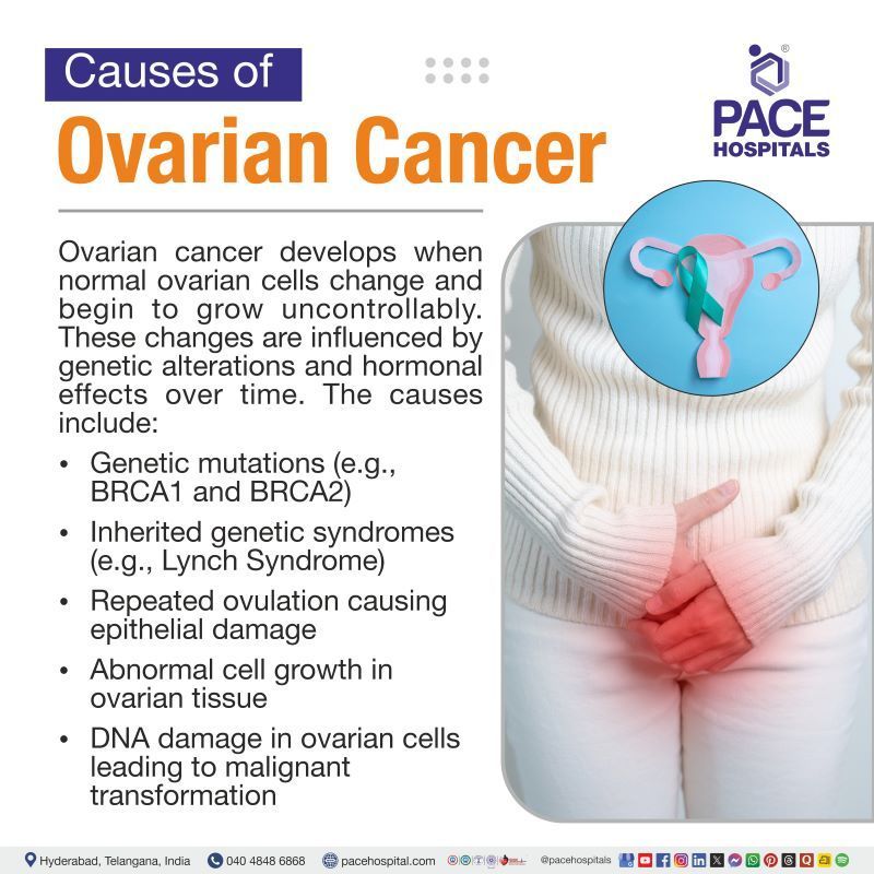 Ovarian Cancer Causes | What causes ovarian cancer | Causes of ovarian cancer