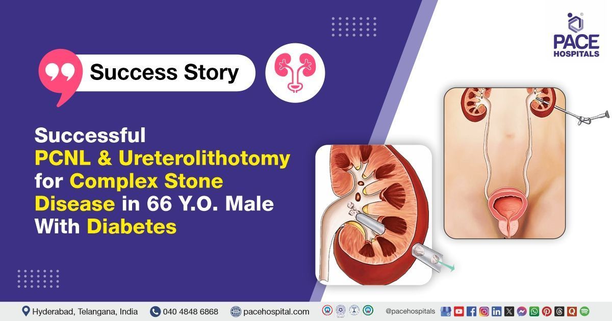 Case study of a patient bilateral kidney and ureteric stones treated at PACE Hospitals, Hyderabad