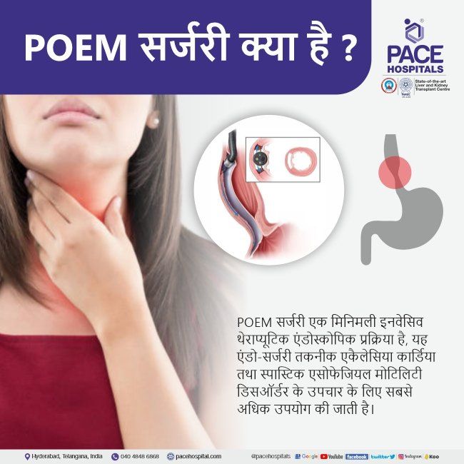 POEM for achalasia cardia in Hindi | POEM surgery in Hindi