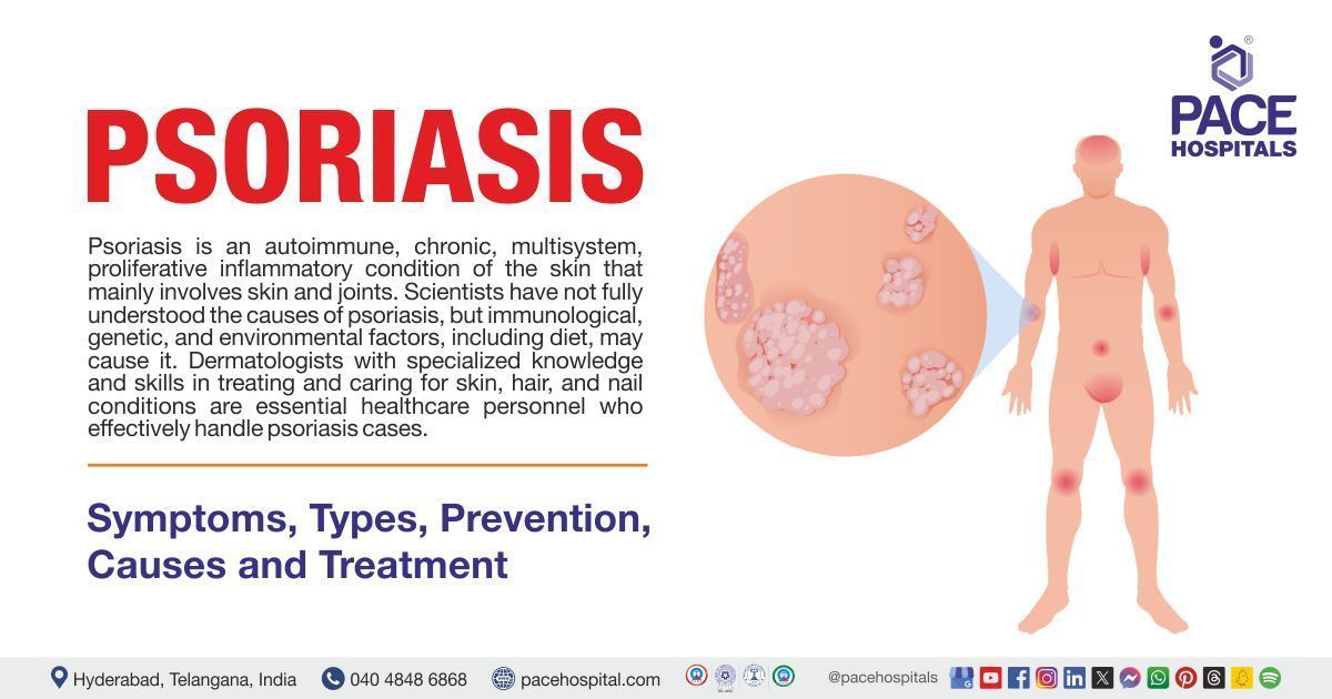 What is Psoriasis | Psoriasis treatment in India | Psoriasis causes, signs and Symptoms