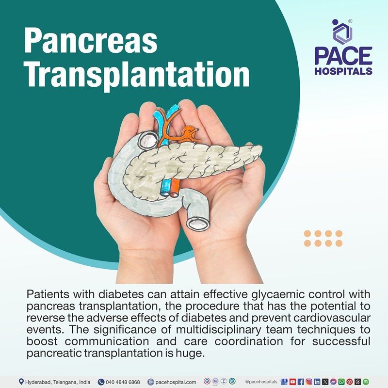 can a pancreas be transplanted | pancreas transplant surgery