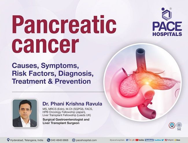 Pancreatic Cancer - Causes, Symptoms, Risk Factors, Diagnosis & Preventions | Dr Phani Krishna