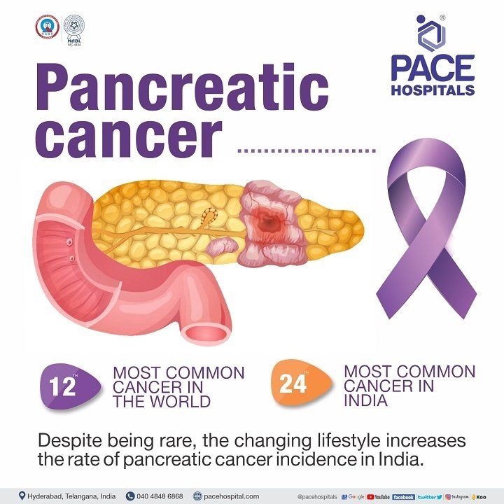 what is pancreatic cancer | types of pancreatic cancer