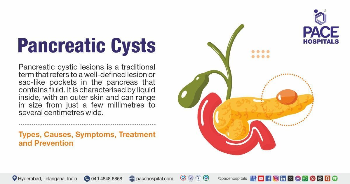 Pancreatic cysts cause & Symptoms | Pancreatic cysts' treatment in India | What is Pancreatic cysts