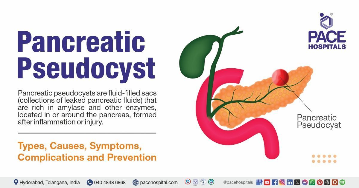 Pancreatic pseudocysts symptoms & causes | Pancreatic pseudocysts treatment in India