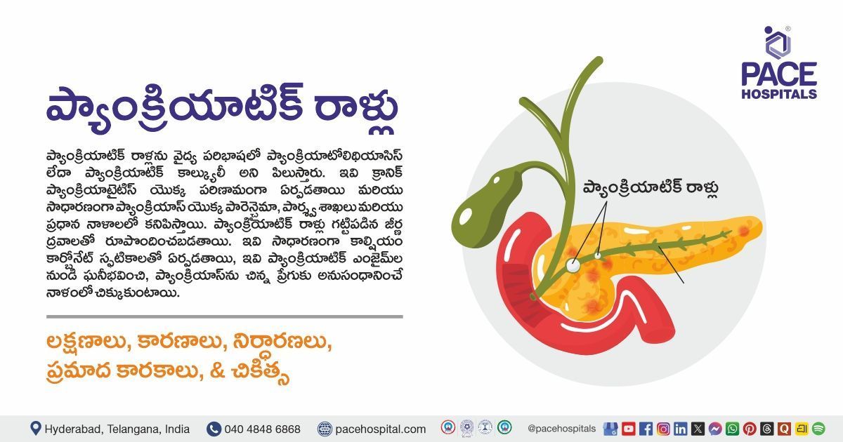 Pancreatic Stones causes, symptoms, diagnosis & treatment in Telugu | Pancreatic Stones in Telugu