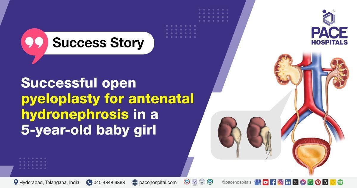 Open Pyeloplasty