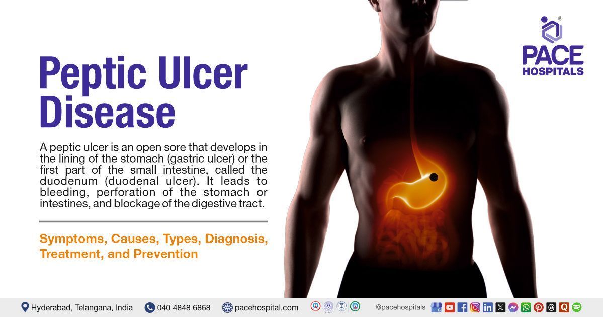 Peptic ulcers Symptoms & Causes | Peptic ulcers Treatment in India | What is Peptic Ulcer