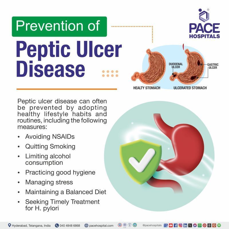 Prevention of Peptic Ulcer Disease | Peptic Ulcer Disease Preventions