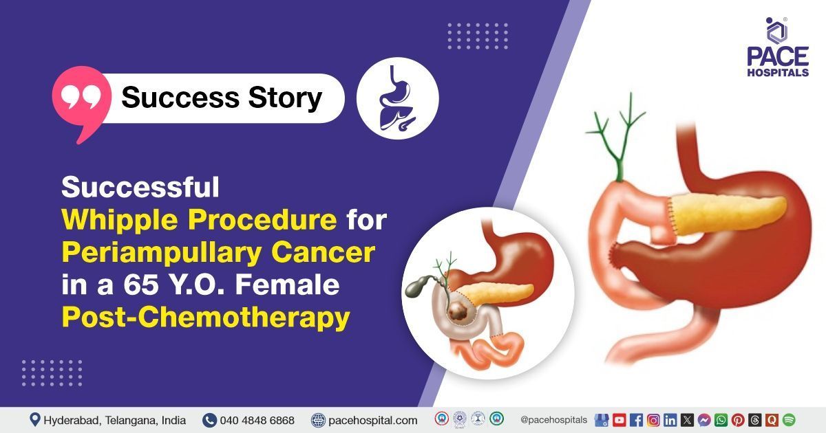 Case study of a patient diagnosed with periampullary cancer, successfully treated at PACE Hospitals.
