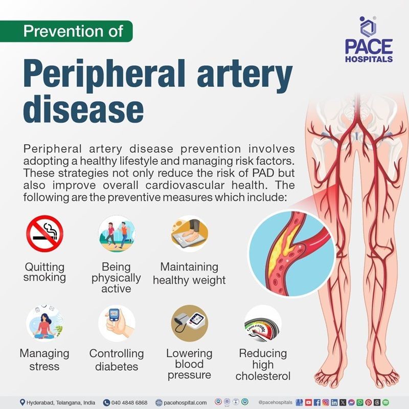 peripheral artery disease prevention​
 | peripheral artery disease preventive measures | What are the preventions of peripheral artery disease | How to prevent peripheral artery disease
