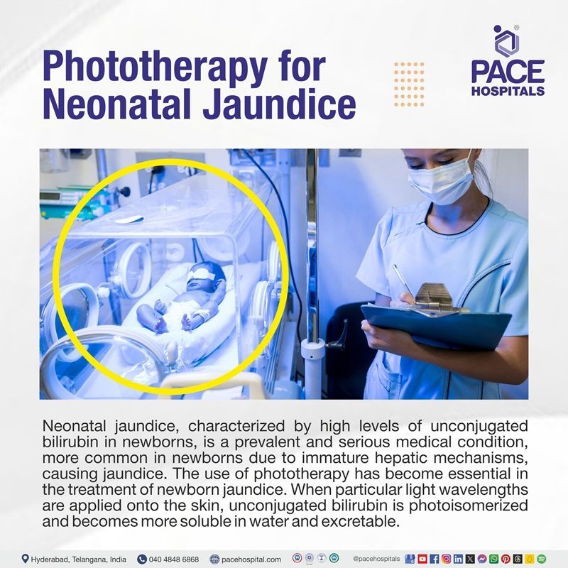 best phototherapy treatment hospital for jaundice in newborn in Hyderabad | phototherapy treatment near me for newborn | phototherapy treatment for baby