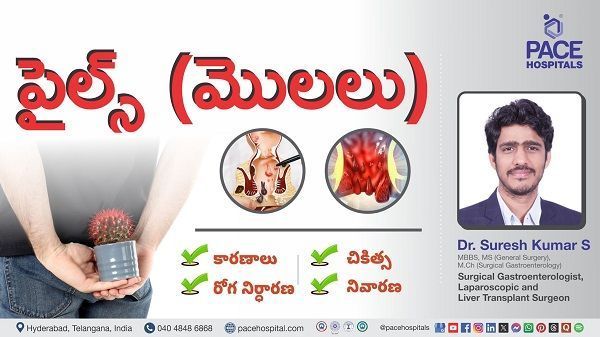 Piles (Haemorrhoids) Causes, Symptoms & Treatment Explained by Dr. Suresh Kumar from PACE Hospitals