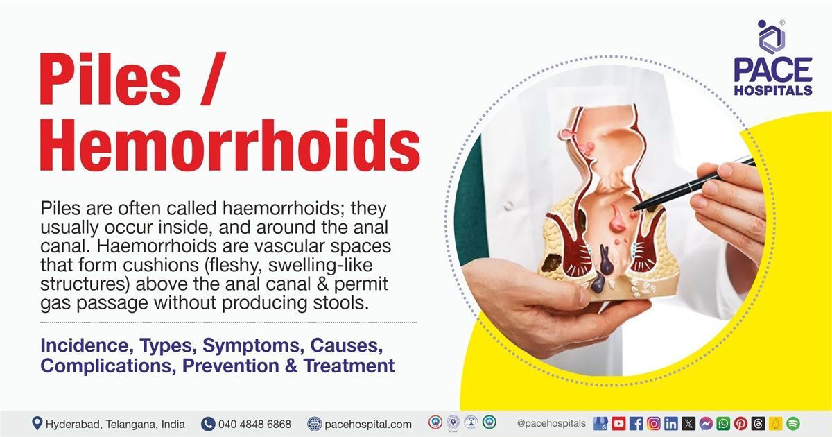Piles causes | hemorrhoids causes | hemorrhoids treatment in India |  Piles treatment in India 