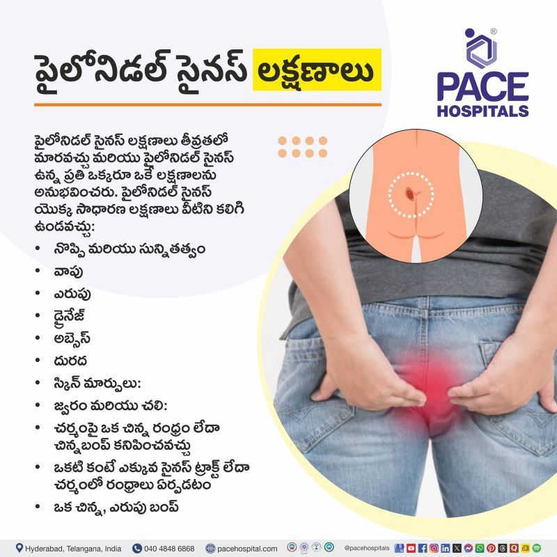 Pilonidal Sinus Symptoms in Telugu | పైలోనిడల్ సైనస్ లక్షణాలు | Symptoms of Pilonidal Sinus in Telugu