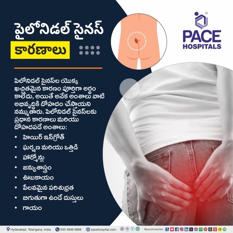 Pilonidal Sinus Causes in Telugu | పైలోనిడల్ సైనస్ కారణాలు  | Causes of Pilonidal Sinus in Telugu