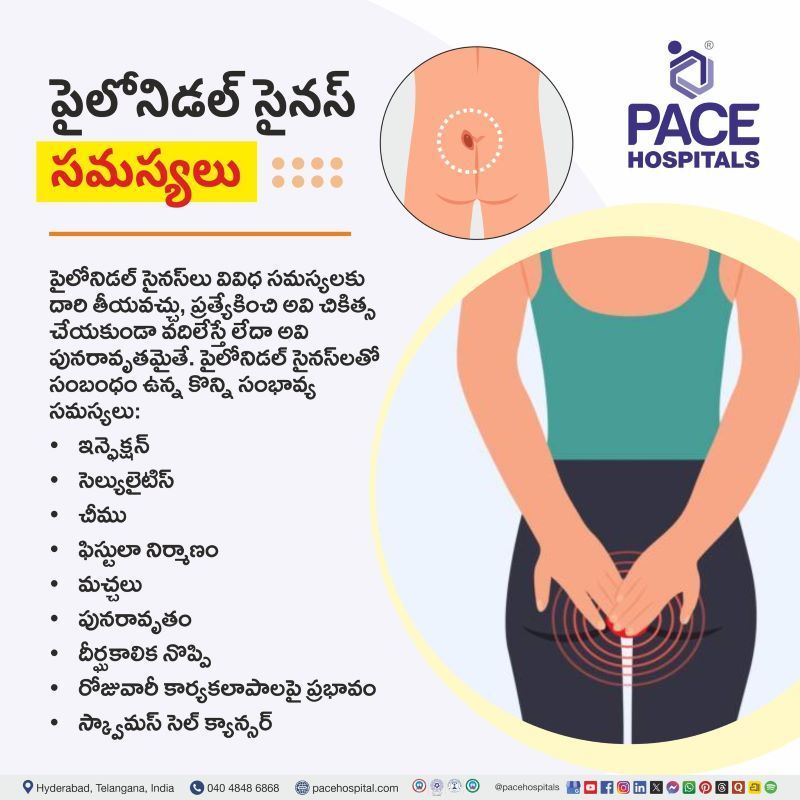 Pilonidal Sinus Complications in Telugu | పైలోనిడల్ సైనస్ సమస్యలు | Complications of Pilonidal Sinus in Telugu