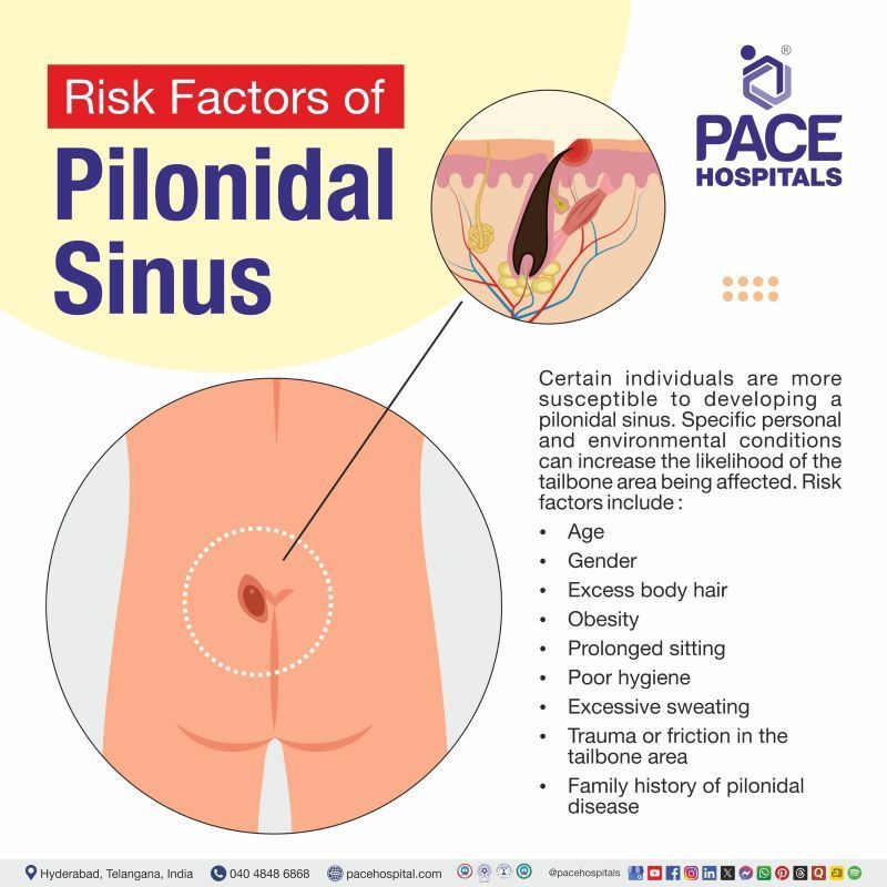Pilonidal Sinus Risk Factors Pilonidal Sinus Risk Factors | Risk factors of pilonidal sinus