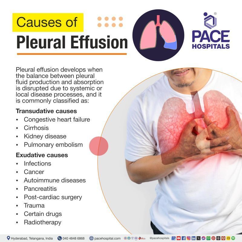 Pleural Effusion Causes Symptoms Diagnosis Treatment