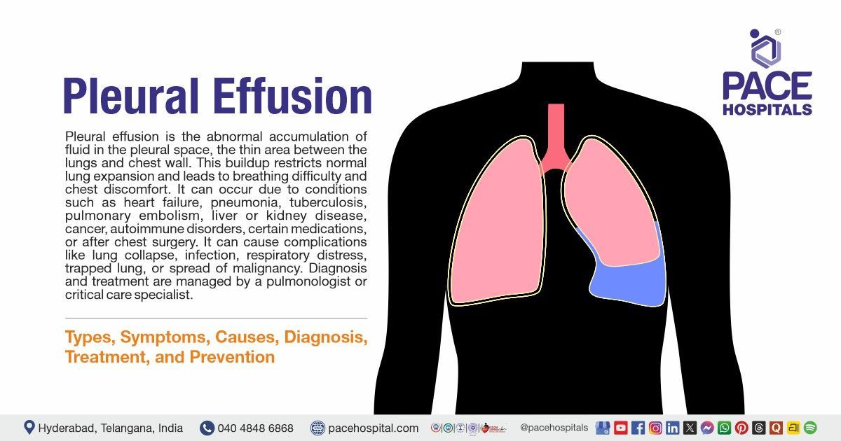 Pleural Effusion Causes, Symptoms, Types, Diagnosis & Treatment | What is Pleural Effusion