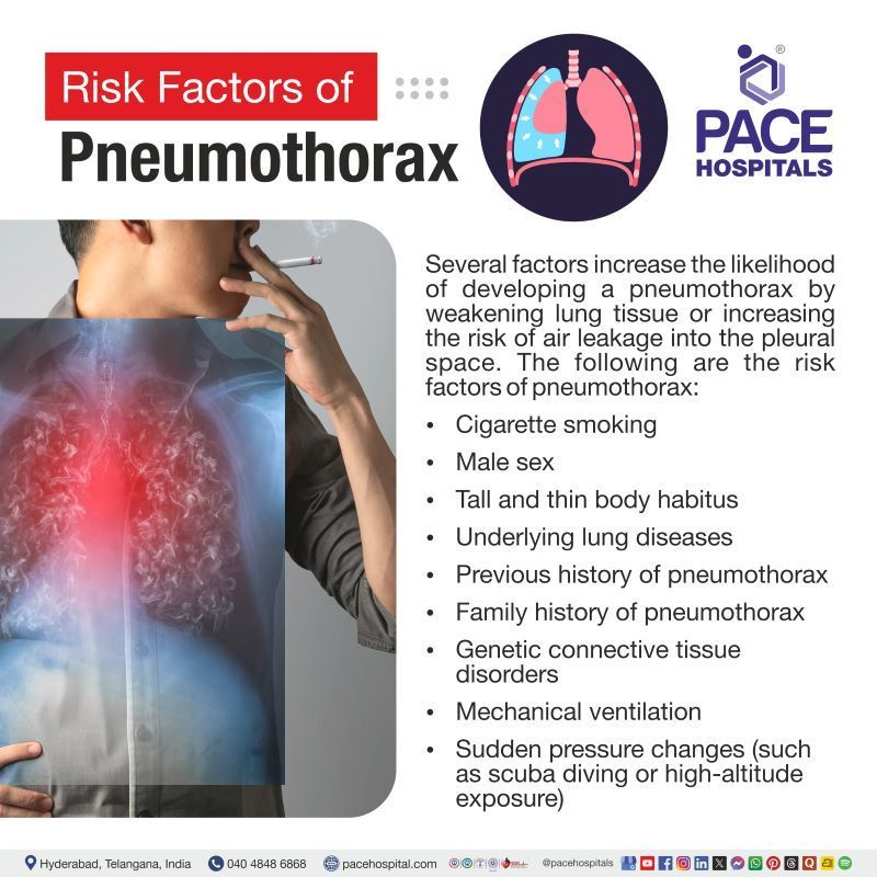 Pneumothorax Risk Factors | Risk factors for Pneumothorax