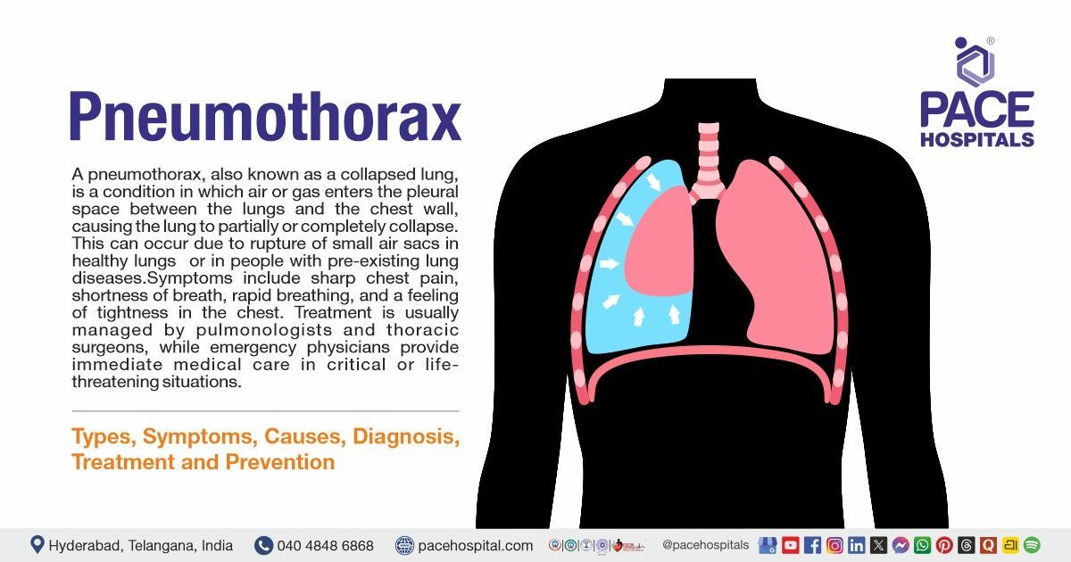 Pneumothorax Symptoms, Causes, Types, Diagnosis, Treatment & Prevention | What is Pneumothorax