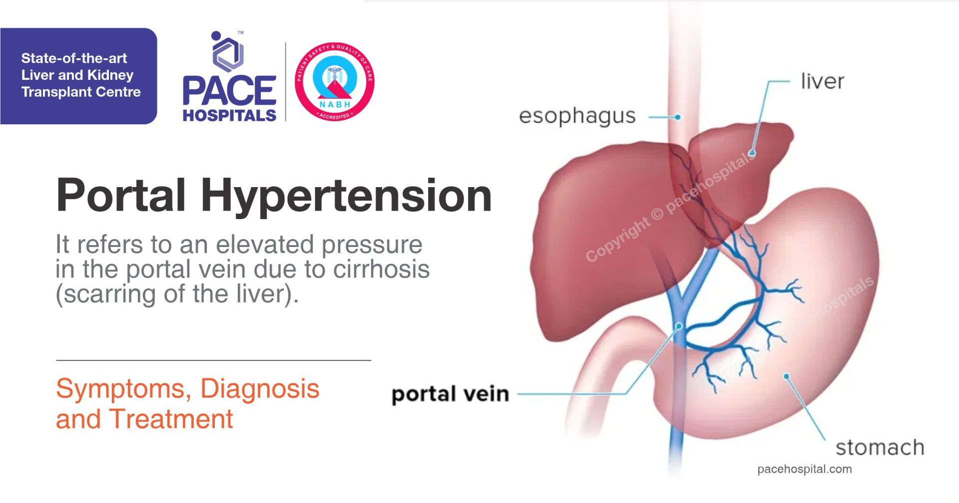 portal hypertension symptoms and treatment)