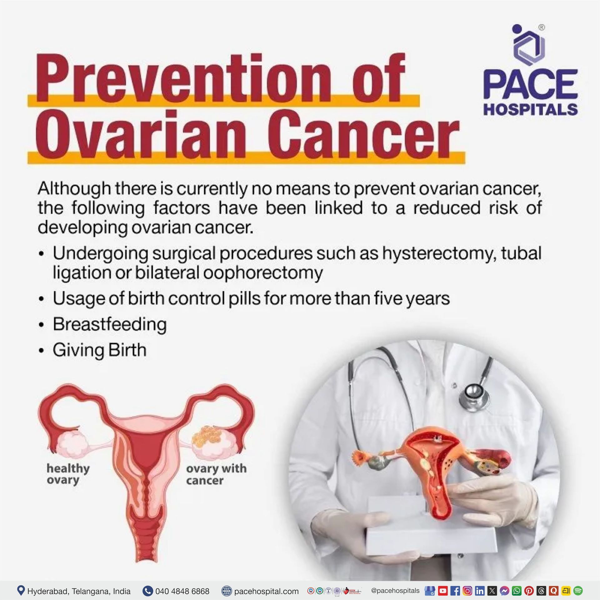 Prevention of ovarian cancer | Ovarian Cancer Preventive measures