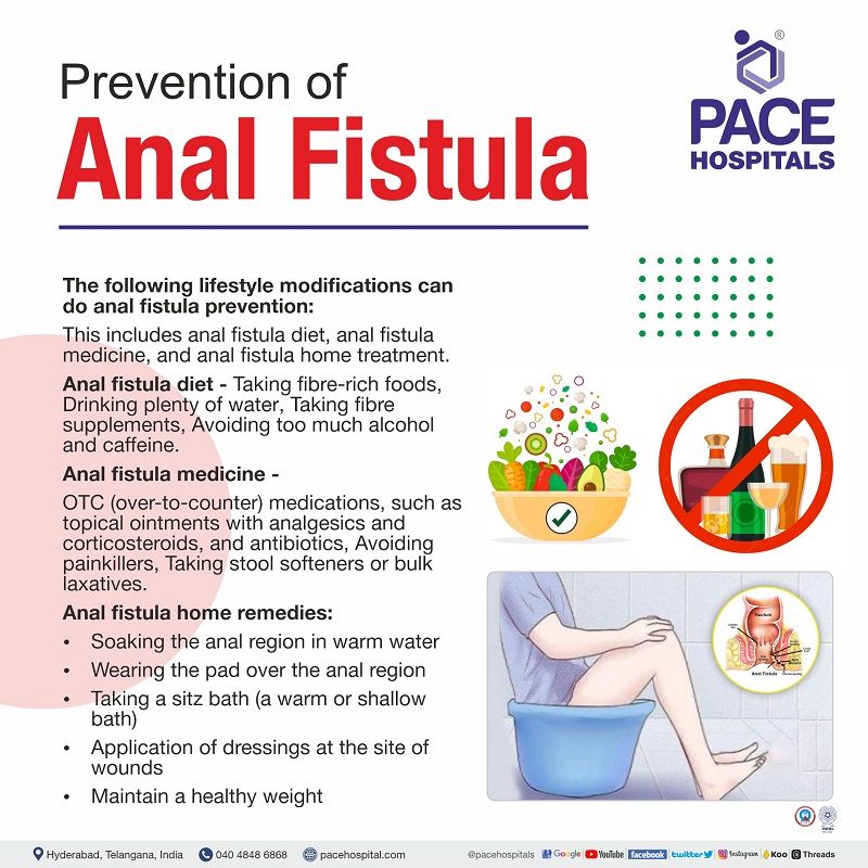 anal fistula prevention | how to prevent anal fistula | how to prevent fistula in ano | prevention of fistula in ano
