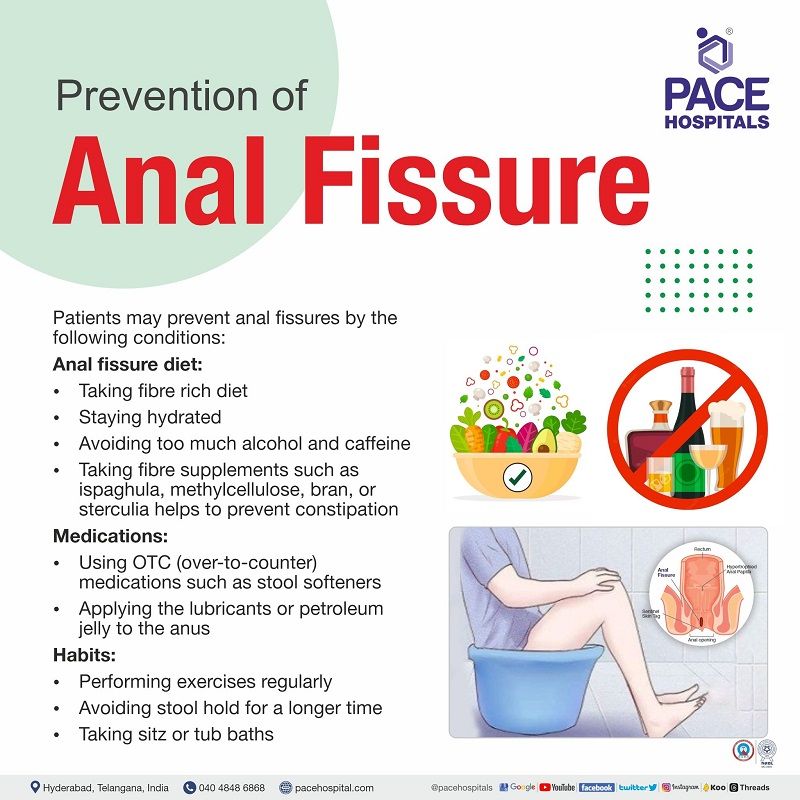 anal fissure prevention | how to prevent anal fissures | preventive measures of anal fissures | preventìon from anal fissure