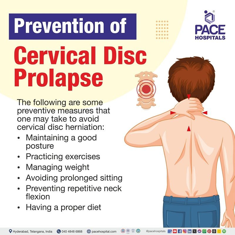 Cervical disc prolapse preventions | preventions of Cervical disc prolapse | Cervical disc herniations preventions | Preventions for Cervical disc herniation | Visual  outlining the preventive tips of Cervical disc prolapse