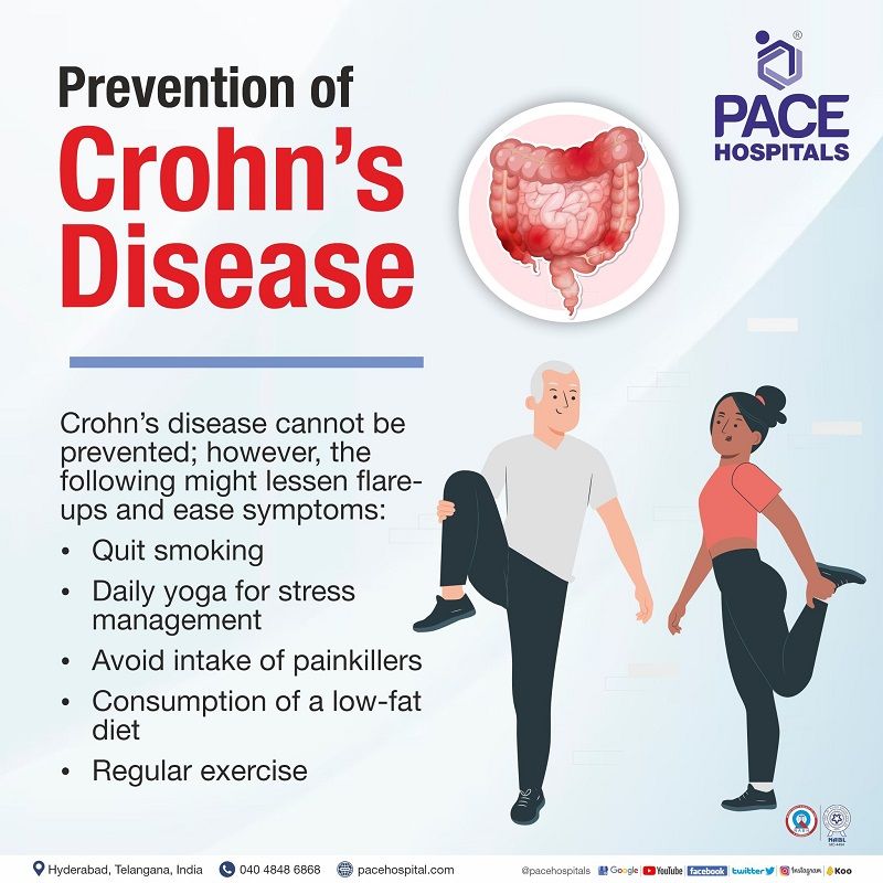 crohn's disease prevention | crohns disease primary prevention