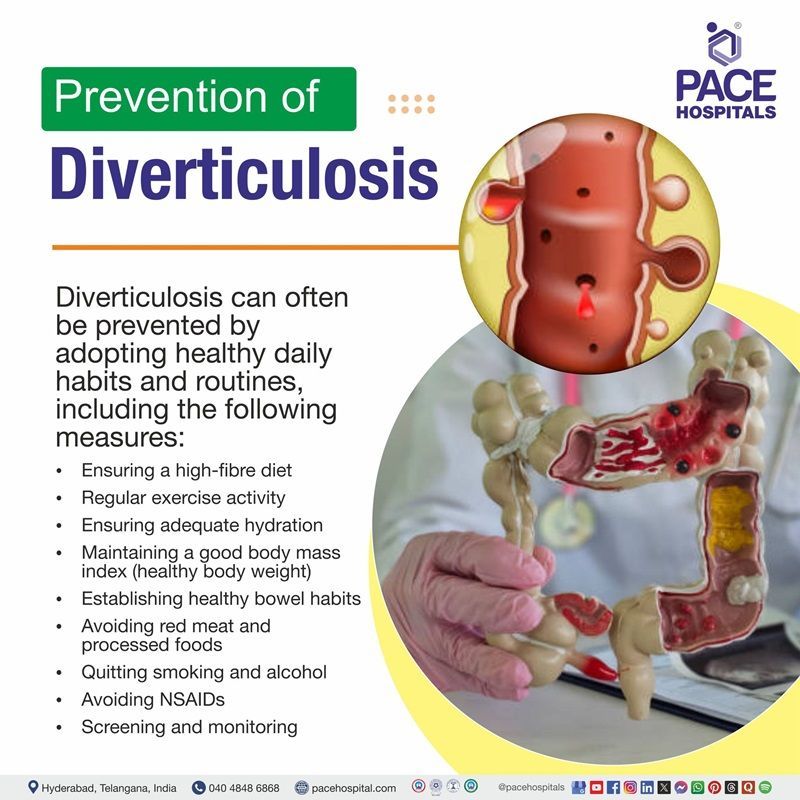 Diverticulosis Prevention Diverticulosis Preventive measures | Diverticulosis Preventive tips