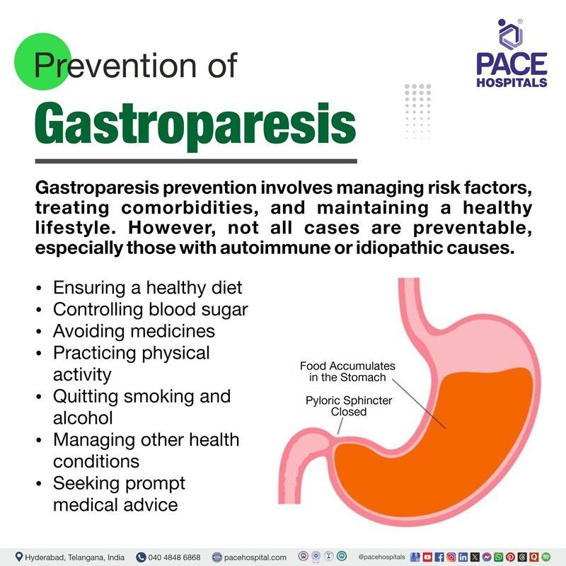 Gastroparesis Prevention | Prevention of Gastroparesis