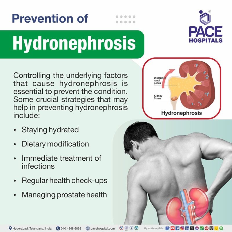 Kidney hydronephrosis prevention | Prevention of hydronephrosis | gross and mild hydronephrosis prevention