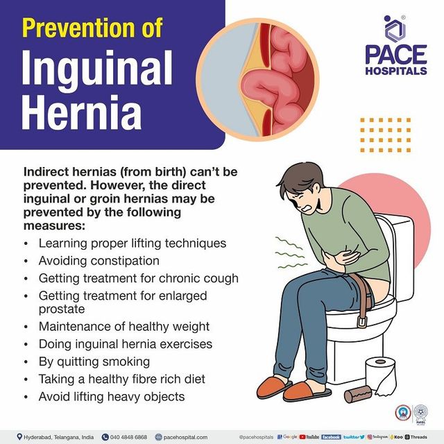 Inguinal hernia: Risk factors, prevention, symptoms, complications
