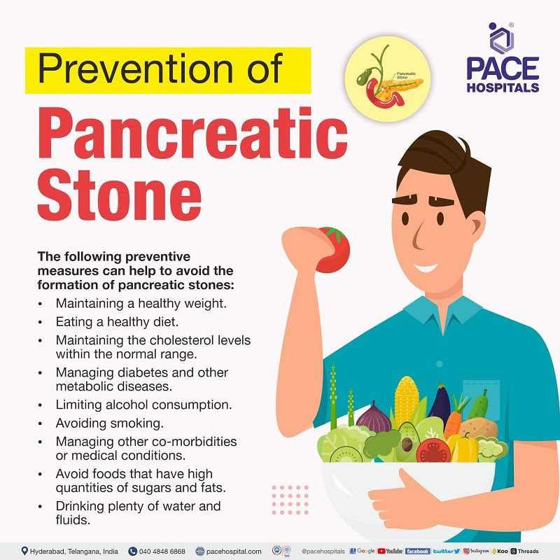 prevention of pancreas stones | pancreatic stones prevention | pancreatolithiasis preventive tips | pancreatic calculi prevention