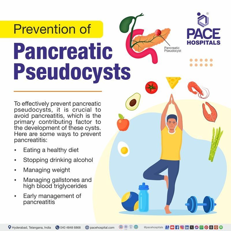 pancreatic pseudocyst preventions | Image displaying the preventions of pancreatic pseudocyst
