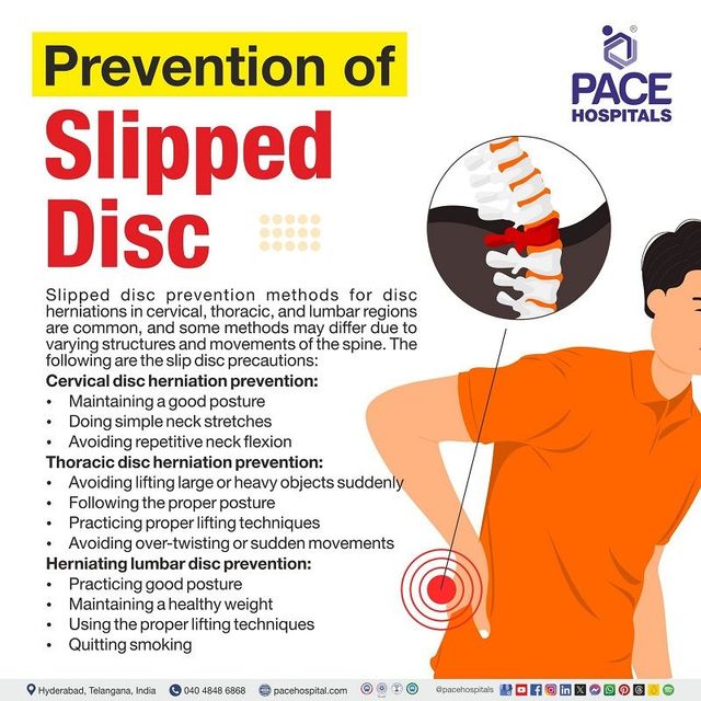 Slipped disc (Herniated disc)- Causes, Symptoms and Treatment