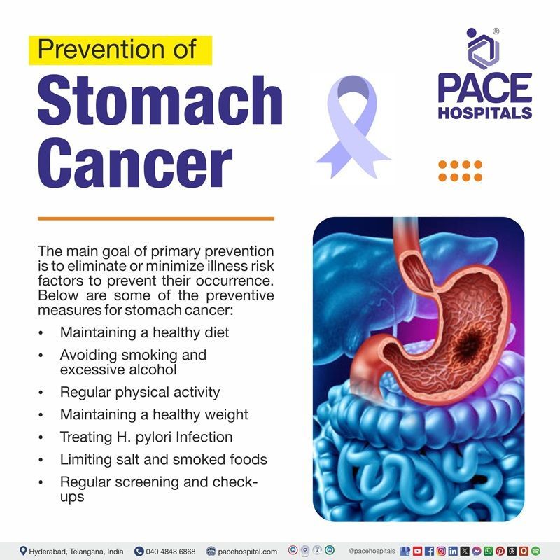 Stomach cancer preventions | image showing the stomach cancer diagram and stomach cancer prevention measures