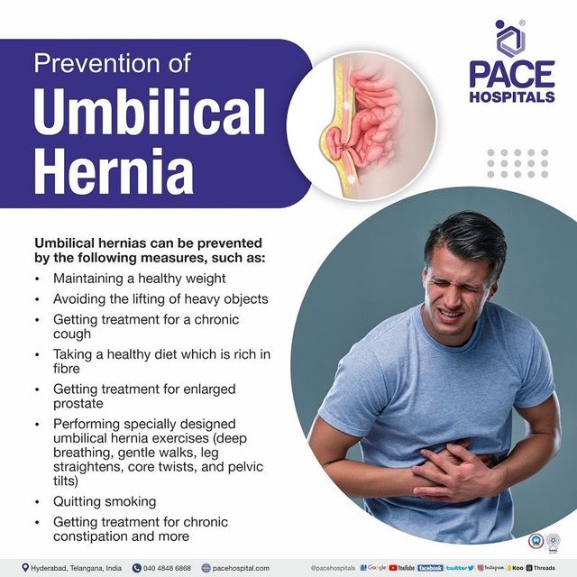 Umbilical Hernia: Causes, Symptoms, Risk Factors, Diagnosis, Treatment and  Complications