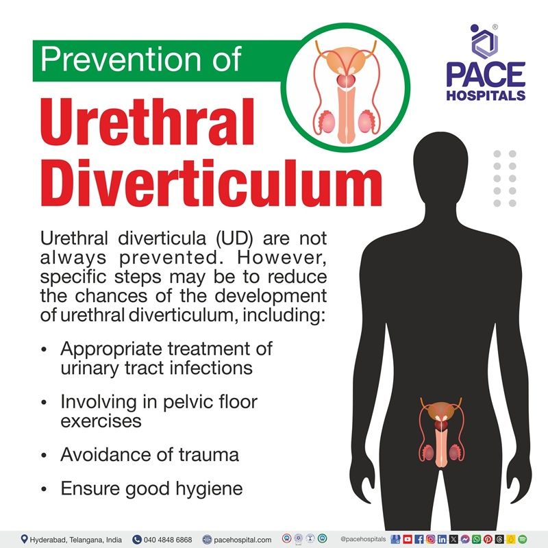 Preventions of Urethral diverticulum | Urethral diverticulum Preventions | Urethral diverticulum preventive measures | Visual depicting the Preventive measures of urethral diverticulum