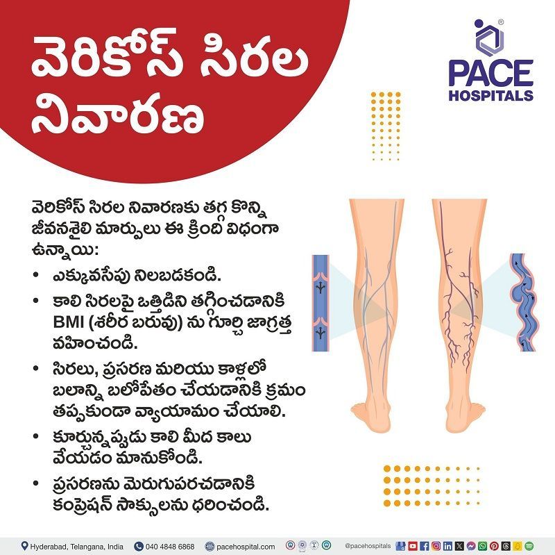 Varicose veins preventive measures in Telugu | తెలుగులో అనారోగ్య సిరలు నివారణ చర్యలు | అనారోగ్య సిరలు నిరోధించడానికి ఎలా | how to prevent varicose veins in Telugu | preventions of varicose veins in Telugu | అనారోగ్య సిరలు నివారణ
